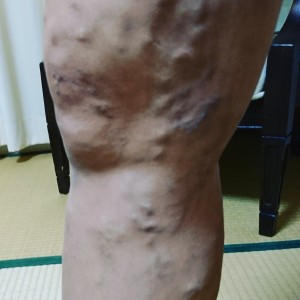 IMG_20181124_172338_509